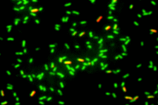 サルモネラ菌をSYTO9（緑）とPI（赤）の2重蛍光染色したもの