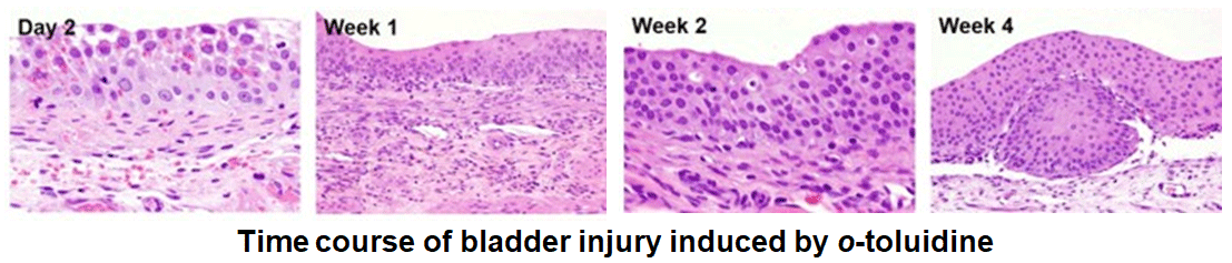 Time course of bladder injury induced by o-toluidine