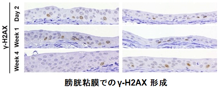 膀胱粘膜での γ-H2AX 形成